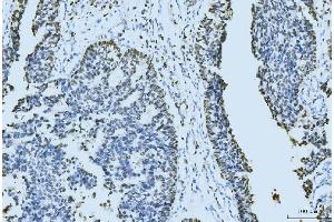 IHC analysis of MCM6 using anti-MCM6 antibody (ABIN7600037).