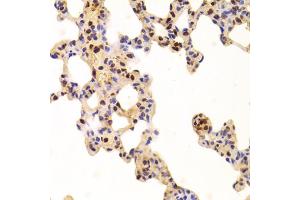 Immunohistochemistry of paraffin-embedded rat lung using ANP32A Antibody (ABIN5973390) at dilution of 1/100 (40x lens). (PHAP1 antibody)