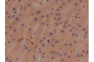 DAB staining on IHC-P; Samples: Human Liver Tissue (BMP1 antibody  (AA 610-843))