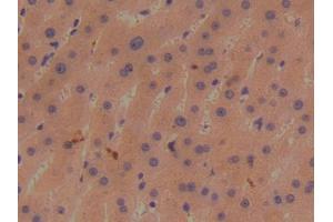 DAB staining on IHC-P; Samples: Human Liver Tissue (BMP1 antibody  (AA 610-843))