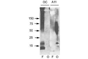 Amyloid Fibrils Western Blot. (Amyloid Fibrils antibody)