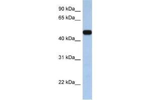 Western Blotting (WB) image for anti-Solute Carrier Family 25, Member 46 (SLC25A46) antibody (ABIN2458810) (SLC25A46 antibody)