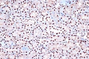 Immunohistochemistry of paraffin-embedded mouse kidney using KHSRP Rabbit mAb (ABIN7268110) at dilution of 1:100 (40x lens). (KHSRP antibody)
