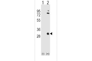 Western blot analysis of OA1 (arrow) using rabbit polyclonal OA1 Antibody (N-term) 7414a.