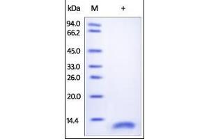 Human CD9, His Tag on SDS-PAGE under reducing (R) condition.