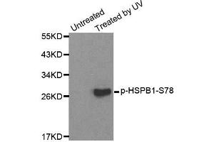 Western blot analysis of extracts from HL60 cells, using Phospho-HSPB1-S78 antibody (ABIN2987689). (HSP27 antibody  (pSer78))