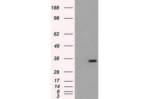 Image no. 1 for anti-Fc Fragment of IgG, Low Affinity IIa, Receptor (CD32) (FCGR2A) antibody (ABIN1497258) (FCGR2A antibody)