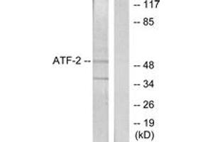 Western blot analysis of extracts from HeLa cells, using ATF2 (Ab-62 or 44) Antibody. (ATF2 antibody  (AA 29-78))