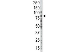 Western blot analysis of anti-PKC alpha antibody in placenta lysate (PKC alpha antibody  (AA 299-329))