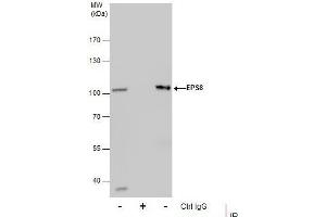 IP Image Immunoprecipitation of EPS8 protein from HepG2 whole cell extracts using 5 μg of EPS8 antibody [C3], C-term, Western blot analysis was performed using EPS8 antibody [C3], C-term, EasyBlot anti-Rabbit IgG  was used as a secondary reagent.