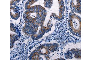 Immunohistochemistry (IHC) image for anti-Dual Specificity Phosphatase 6 (DUSP6) antibody (ABIN2428102) (DUSP6 antibody)