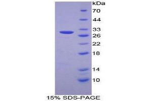 SDS-PAGE (SDS) image for Proteasome (Prosome, Macropain) 26S Subunit, Non-ATPase, 2 (PSMD2) (AA 645-872) protein (His tag) (ABIN1877519) (PSMD2 Protein (AA 645-872) (His tag))