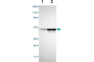 Western blot analysis of Lane 1: Human cell line RT-4, Lane 2: Human cell line U-251MG sp with AURKA polyclonal antibody . (Aurora A antibody)