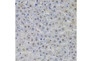 Immunohistochemistry (Paraffin-embedded Sections) (IHC (p)) image for anti-Small Nuclear Ribonucleoprotein Polypeptide A (SNRPA) (AA 1-282) antibody (ABIN6148210)