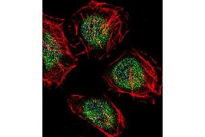 Fluorescent confocal image of Hela cell stained with CAF-1 Antibody (N-term). (CNOT8 antibody  (N-Term))