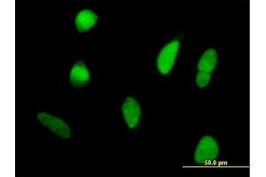 Immunofluorescence of purified MaxPab antibody to DDX42 on HeLa cell. (DDX42 antibody  (AA 1-819))