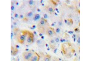 Used in DAB staining on fromalin fixed paraffin-embedded Liver tissue (MST1R antibody  (AA 1092-1316))