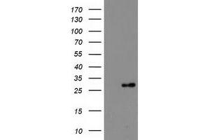 Western Blotting (WB) image for anti-Deoxythymidylate Kinase (Thymidylate Kinase) (DTYMK) antibody (ABIN1497925)