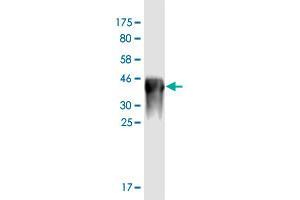 Western Blot detection against Immunogen (36. (HNF1A antibody  (AA 532-631))