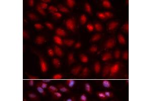 Immunofluorescence analysis of U2OS cells using SUMO2 Polyclonal Antibody (SUMO2 antibody)