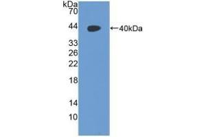 Detection of Recombinant RAD51, Human using Polyclonal Antibody to RAD51 Homolog (RAD51) (RAD51 Homolog antibody  (AA 2-339))