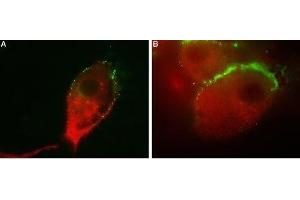 Colocalization of GluR1 and Vesicular GABA Transporter in human U-87 MG cells - Immunocytochemical staining of human glioblastoma U-87 MG. (SLC32A1 antibody  (Cytosolic, N-Term))