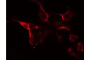 ABIN6274726 staining 293 by IF/ICC. (MRPL10 antibody  (C-Term))