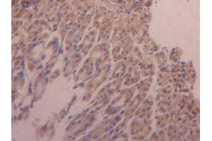 DAB staining on IHC-P; Samples: Mouse Adrenal gland Tissue (Hexokinase 1 antibody  (AA 530-675))
