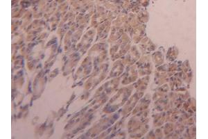 DAB staining on IHC-P; Samples: Mouse Adrenal gland Tissue