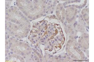 Image no. 4 for anti-Beclin 1, Autophagy Related (BECN1) antibody (ABIN363435) (Beclin 1 antibody)