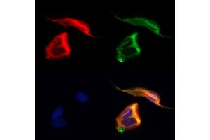 ABIN7094145 and ABIN7098189 staining Hela cells by IF/ICC.