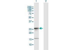 Western Blot analysis of LIN28 expression in transfected 293T cell line by LIN28 MaxPab polyclonal antibody. (LIN28A antibody  (AA 1-209))