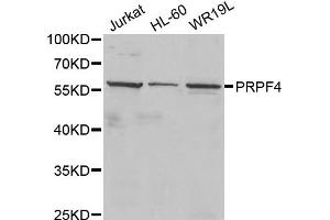 Western Blotting (WB) image for anti-PRP4 Pre-mRNA Processing Factor 4 Homolog (PRPF4) antibody (ABIN1877079) (PRPF4 antibody)