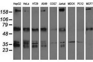 Western blot analysis of extracts (35 µg) from 9 different cell lines by using anti-IGF2BP2 monoclonal antibody. (IGF2BP2 antibody)