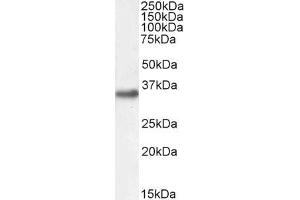 ABIN185576 (1µg/ml) staining of Mouse Brain lysate (35µg protein in RIPA buffer). (EN2 antibody  (C-Term))