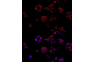 Immunofluorescence analysis of HeLa cells using CD40L antibody (ABIN6133614, ABIN6138190, ABIN6138191 and ABIN6216826) at dilution of 1:100. (CD40 Ligand antibody  (AA 79-129))