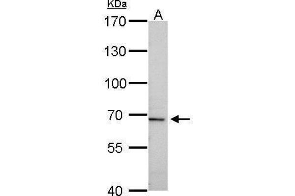 PLAT antibody