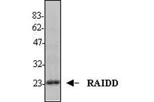 Image no. 1 for anti-CASP2 and RIPK1 Domain Containing Adaptor with Death Domain (CRADD) (AA 1-199) antibody (ABIN187937) (CRADD antibody  (AA 1-199))