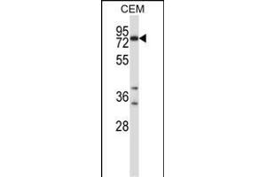 Mouse Plk2 Antibody (Center) (ABIN658003 and ABIN2846947) western blot analysis in CEM cell line lysates (35 μg/lane).