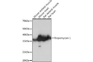 Western blot analysis of extracts of various cell lines, using Tropomyosin 1 Rabbit mAb (ABIN7271013) at 1:1000 dilution. (Tropomyosin antibody)