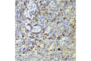 Immunohistochemistry of paraffin-embedded human tonsil using IL18 antibody (ABIN7267992) at dilution of 1:50 (40x lens). (IL-18 antibody)