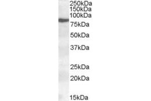 ABIN334342 (0. (ALOX15 antibody  (Internal Region))
