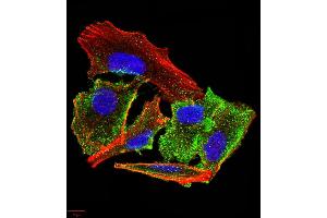 Immunocytochemistry (ICC) image for anti-Transthyretin (TTR) (AA 1-147) antibody (ABIN5875576) (TTR antibody  (AA 1-147))