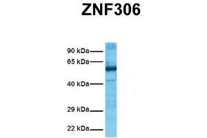 Host:  Rabbit  Target Name:  ZNF306  Sample Tissue:  Human Ovary Tumor  Antibody Dilution:  1. (ZKSCAN3 antibody  (N-Term))