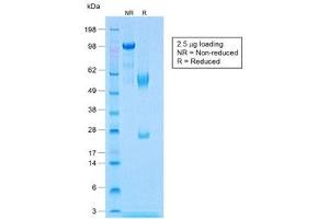 SDS-PAGE analysis of purified, BSA-free recombinant Calponin antibody (clone CNN1/1408R) as confirmation of integrity and purity.