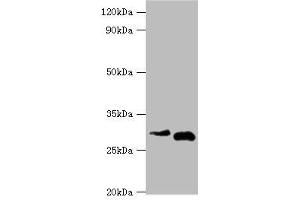 Western blot All lanes: Cerberus antibody at 2 μg/mL Lane 1: Hela whole cell lysate Lane 2: Rat kidney tissue Secondary Goat polyclonal to rabbit IgG at 1/10000 dilution Predicted band size: 30 kDa Observed band size: 30 kDa (CER1 antibody  (AA 18-267))