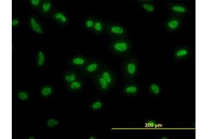 Image no. 3 for anti-TATA Box Binding Protein Associated Factor 11 (TAF11) (AA 158-211) antibody (ABIN598956) (TAF11 antibody  (AA 158-211))