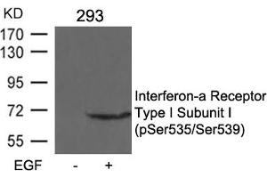 Western blot analysis of extracts from 293 cells untreated or treated with EGF using Interferon-a Receptor Type I Subunit I (phospho-Ser535/Ser539) Antibody. (IFNAR1 antibody  (pSer535, pSer539))