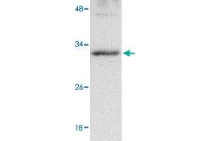 Western blot analysis of GNPDA2 in human kidney tissue lysate with GNPDA2 polyclonal antibody  at 1 ug/mL . (GNPDA2 antibody  (C-Term))