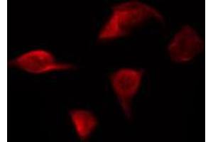 ABIN6267231 staining HepG2 by IF/ICC. (IKK alpha antibody  (pSer176, pSer177))